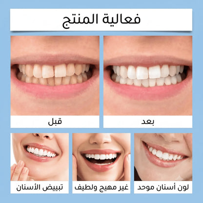 طلاء تبييض الأسنان FEIMUKO – ابتسامة أنظف وثقة أكبر مع كل ابتسامة